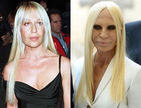 sohn donatella versace|Donatella Versace before and after surgery.